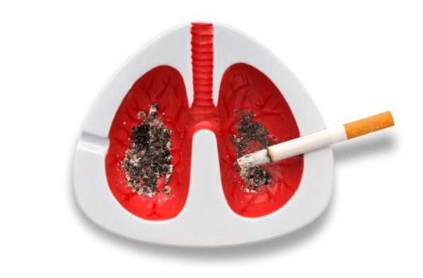 أنواع المدخنين الذين يُصابون بسرطان الرئة