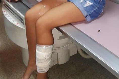 صور إصابة فتاة برصاص طائش في بيروت