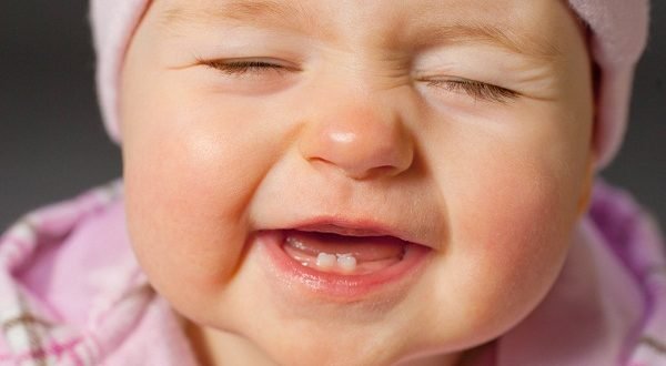 لهذه الاسباب ازدادت نسبة اصابة اسنان الاطفال بالتسوس