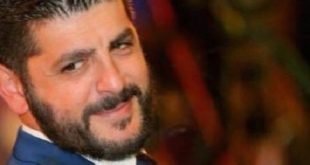 الممثل طوني عيسى يتعرّض لجروح بالوجه