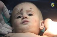 انتشال طفل حي من تحت انقاض مجزرة مستشفى حلب