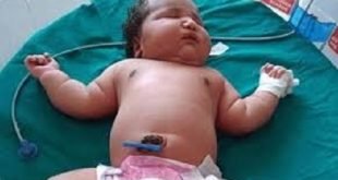 ولادة اسمن طفلة بالعالم تزن 6.8 كيلوغرام