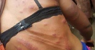 قطر ترحّل هولندية بتهمة الزنا وتجلد الزاني 140 جلدة