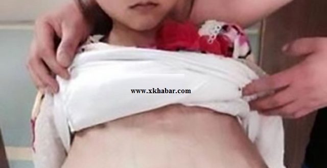 Twelve years old pregnant