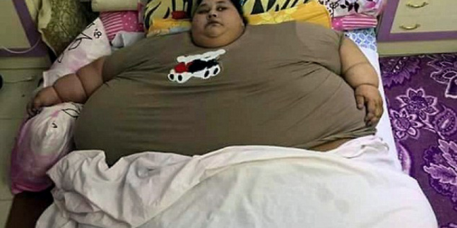 صور ايمان_عبد_العاطي المصرية السمينة بعد العملية