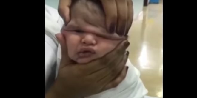 بالفيديو.. فضيحة ممرضات سعوديات يعبثن بوجه طفل رضيع استهزاءً به