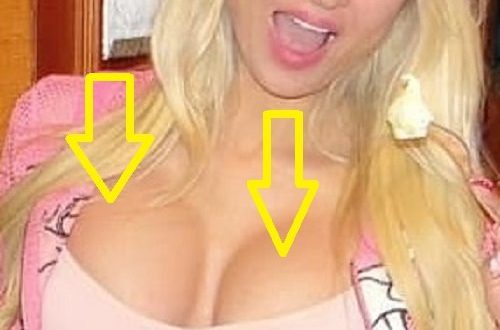 فيديو تكبير صدر ميريام كلينك قبل وبعد